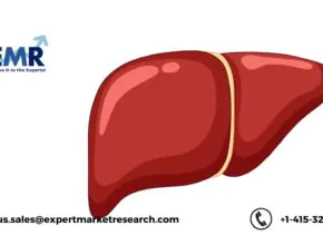 Non-Alcoholic Steatohepatitis (NASH) Treatment Market