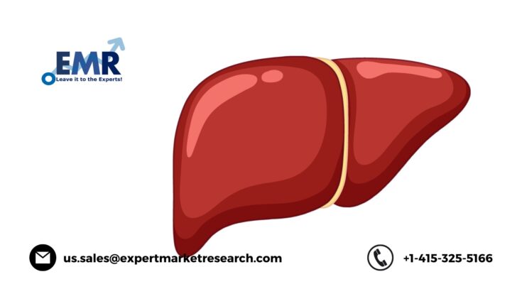 Non-Alcoholic Steatohepatitis (NASH) Treatment Market